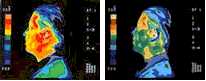 Thermographic image display of head heating by Cellphone and reduction of this by GIA Cell Guard